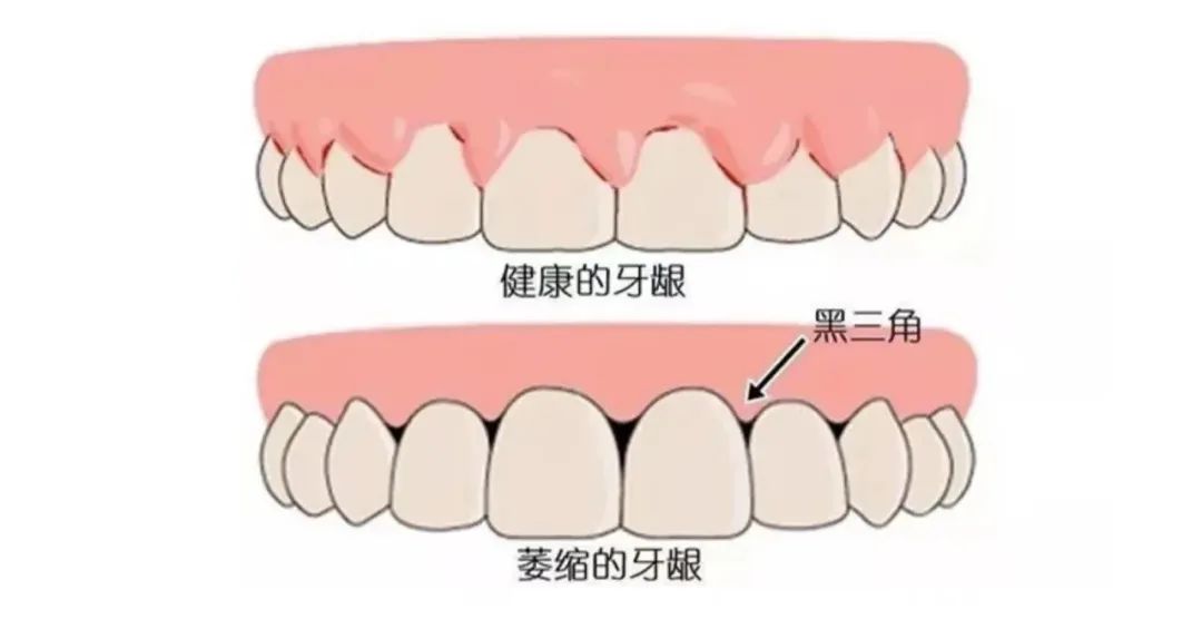 口腔健康-4