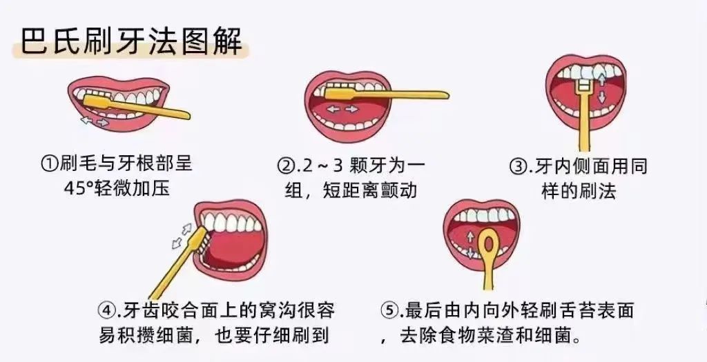 种植牙寿命-6